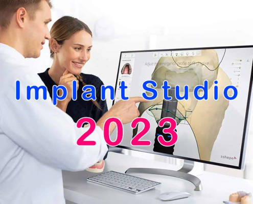 3Shape-Implant-Studio-2023