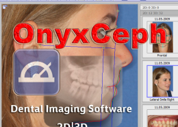 OnyxCeph